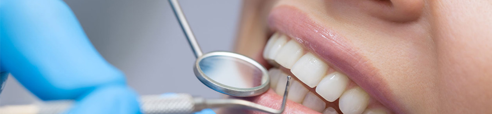 Cabinet dentaire Claude Monet Drs Nguyen traitement composites dentaires
