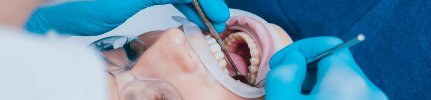 Claude Monet cabinet dentaire Dr Nguyen traitement implantologie