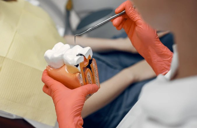 Comprendre l'endodontie au cabinet Dentaire Claude Monet à Croissy-sur-Seine