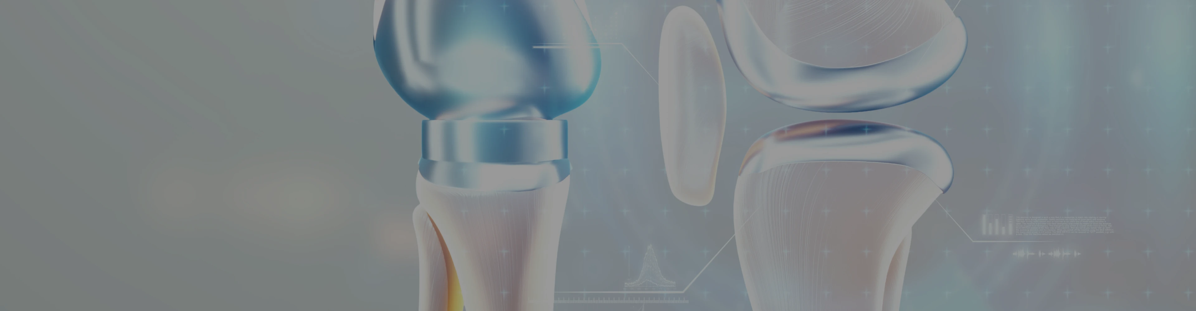 dents-protheses-articulaires-croissy