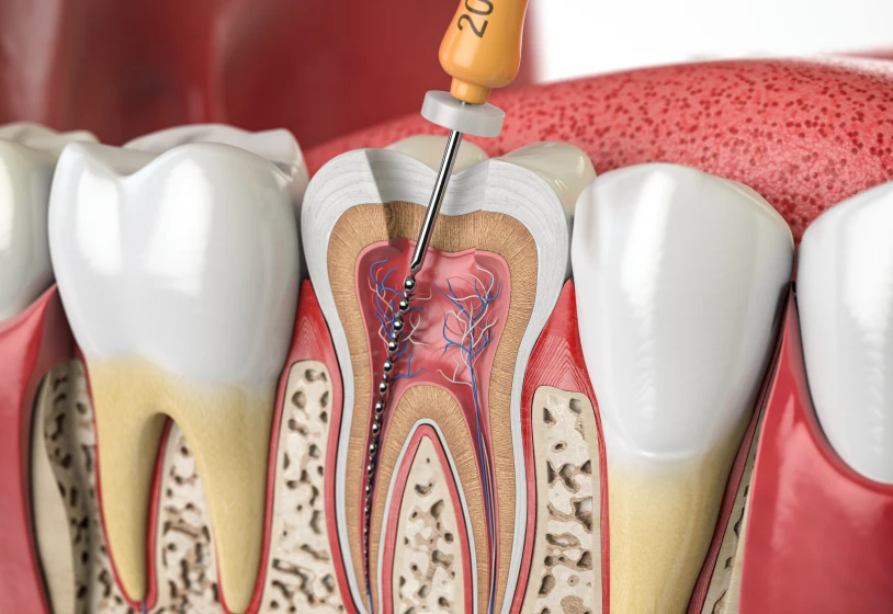 Endodontie