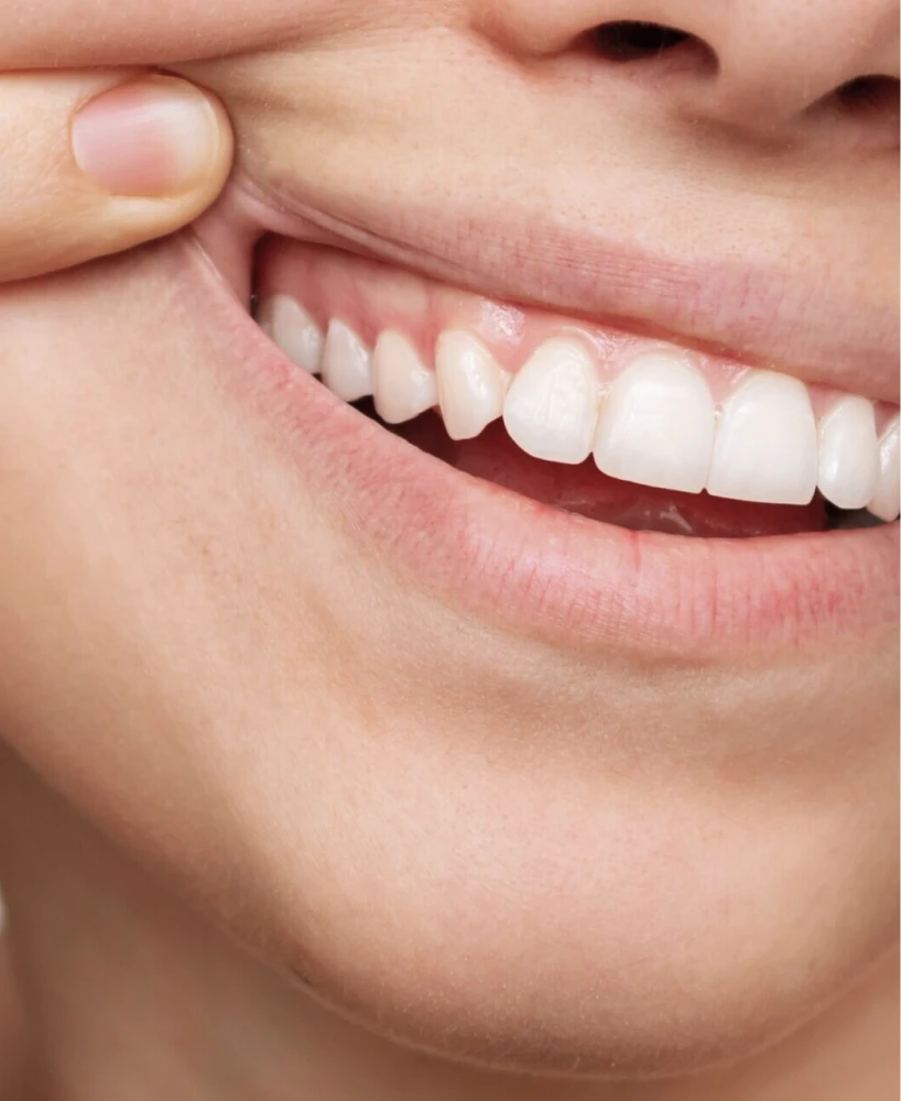 reconnaitre traiter recession gingivale