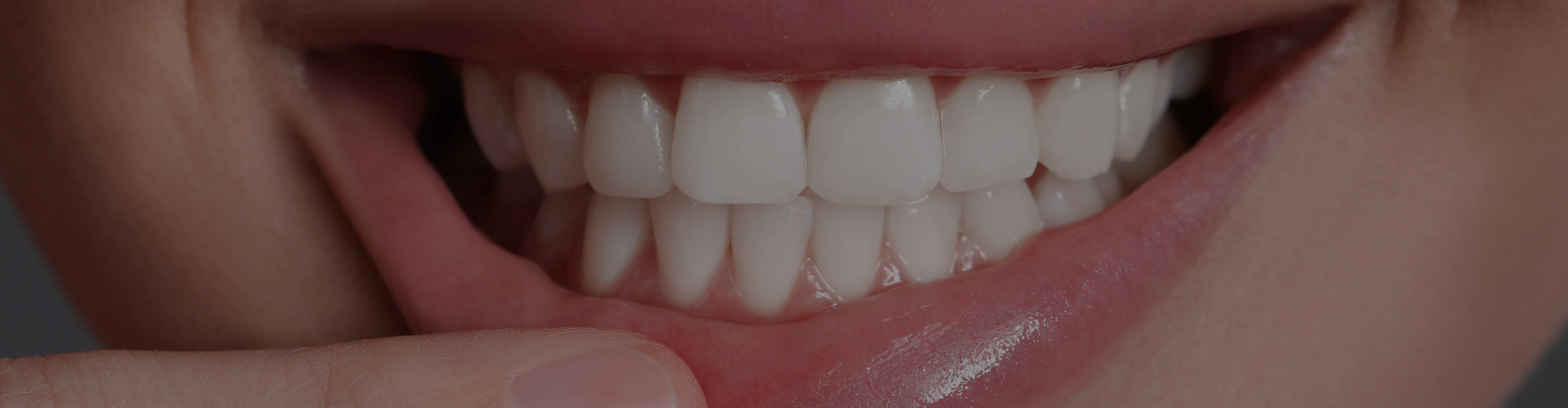 greffe-gingivale-cabinet-claude-monet