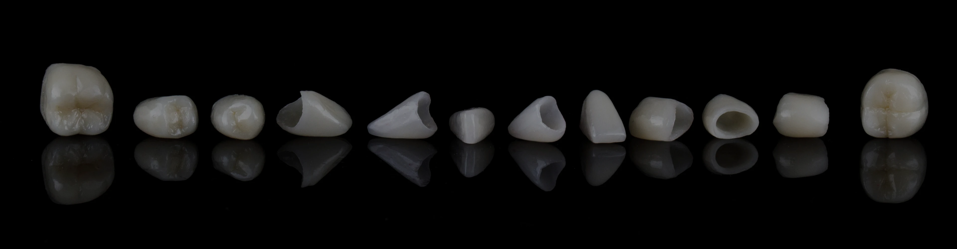 couronnes-ceramique-dentiste-croissy-sur-seine