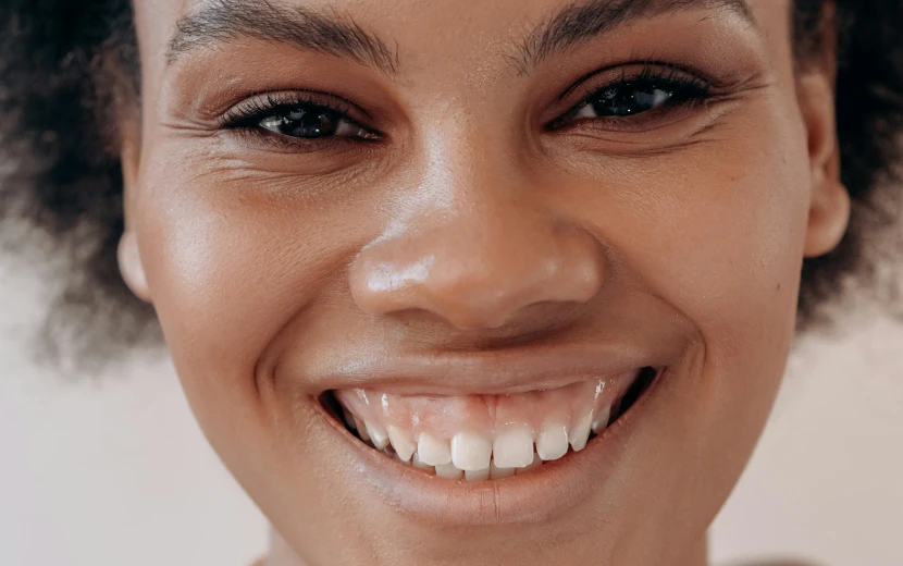 Remodelage des gencives