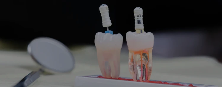 endodontie-cabinet-claude-monet