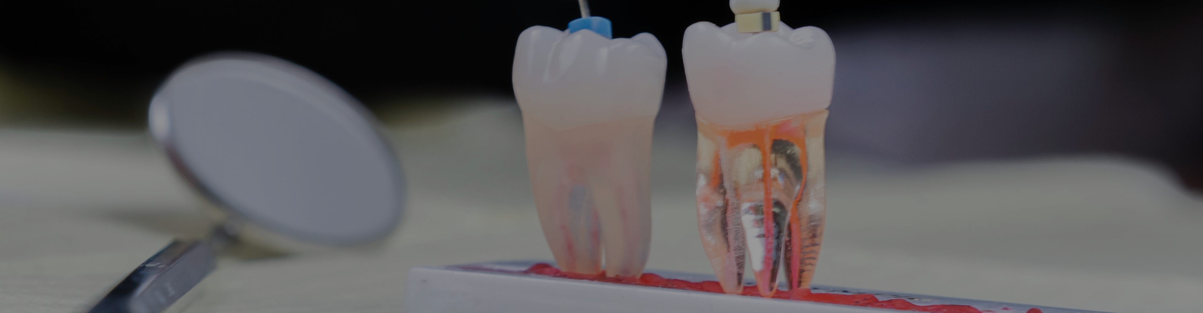 endodontics-treatment