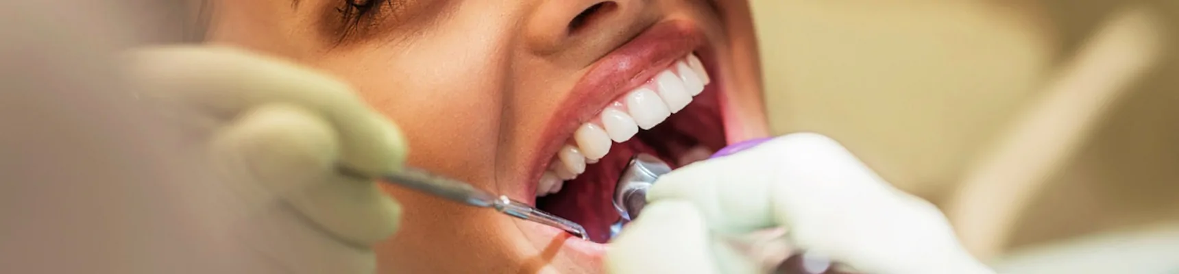 Cabinet dentaire Claude Monet Drs Nguyen traitements parodontie